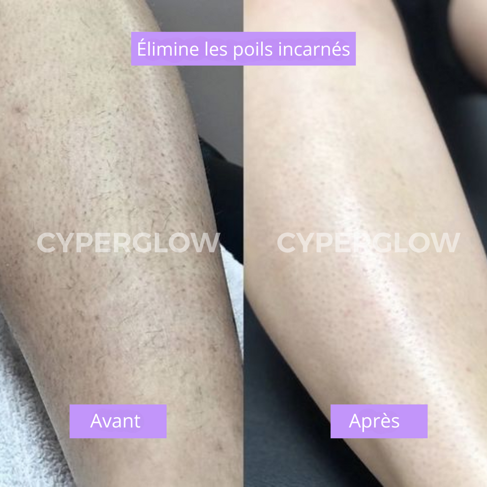 CyperGlow - Sérum Cyperus Rotundus